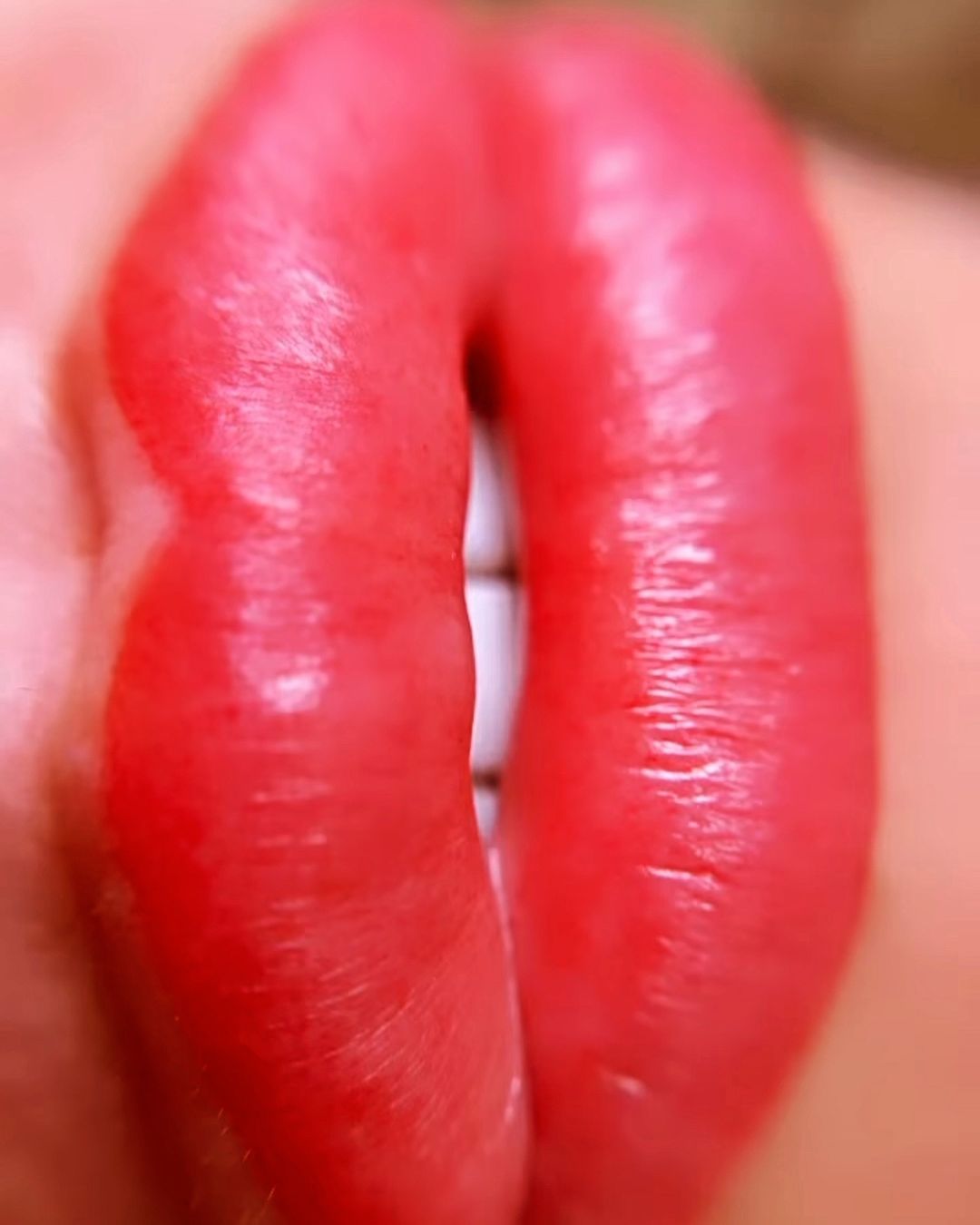 Microlabial